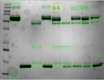 Automated band detection outlining every protein band across the gel